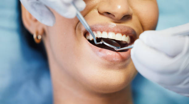 Best Broken or Cracked Tooth Emergency Dentist in Mentor On The Lake, OH